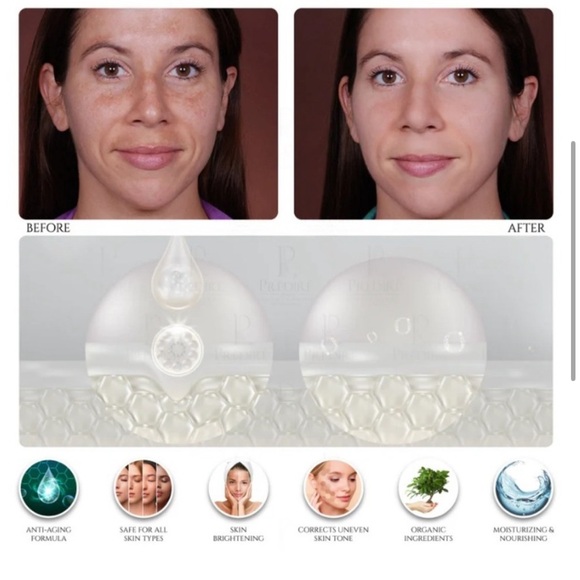 Predire Skincare Set with Device and Serums - Picture 14 of 15